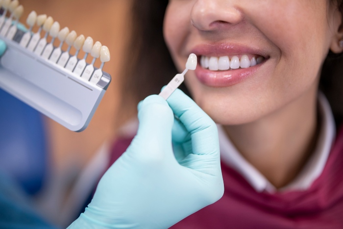 Woman matching shade before dental veneers process in Kalamazoo, MI
