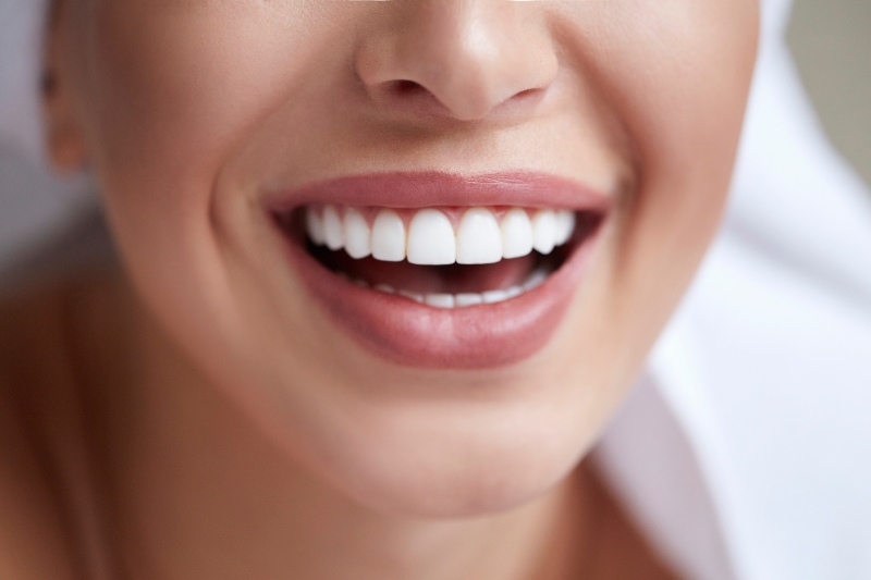 Healthy white smile close up after laser teeth whitening in Kalamazoo, MI