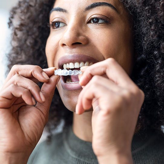 Featured image for “Before and After: Clear Aligner Success Stories from Your Kalamazoo Cosmetic Dentist”